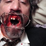 Tad teeth